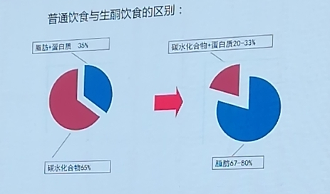 中国生酮饮食疗法专家共识指南解读 中国生酮饮食疗法专家共识指南解读